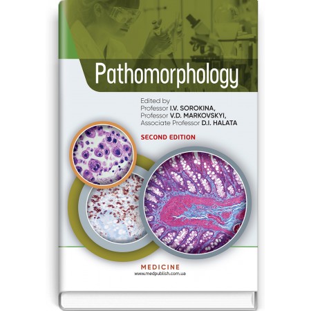 Pathomorphology (textbook) — I.V. Sorokina, V.D. Markovskyi, D.I. Halata et al., 2020