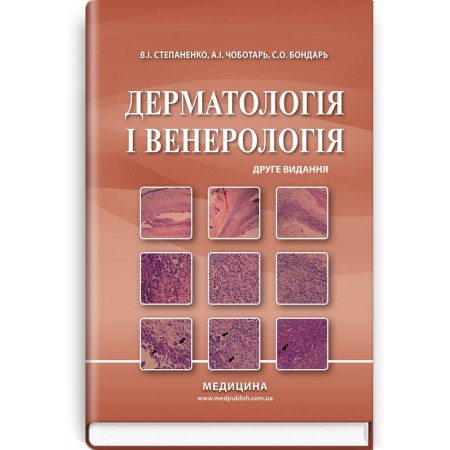 Дерматологія і венерологія (підручник) — В.І. Степаненко, А.І. Чоботарь, С.О. Бондарь, 2020