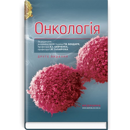 Онкологія (підручник) — Г.В. Бондар, А.I. Шевченко, I.Й. Галайчук, Ю.В. Думанський та ін., 2019